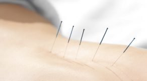 Acupuncture Treatment For Sciatica