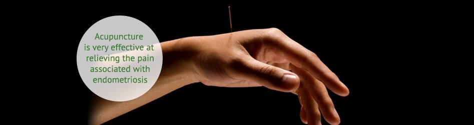 Acupuncture For Arthritis In Orlando