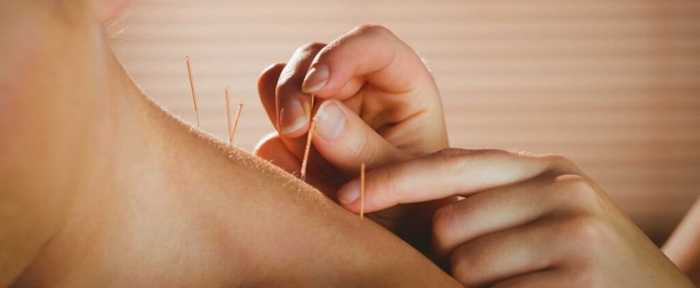 Acupuncture For Neck Pain In Orlando