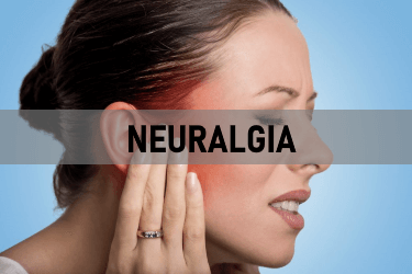 Neuralgia Acupuncture Orlando
